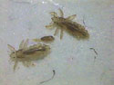 Head Lice Photos (photo) | Nebraska Extension in Lancaster County ...