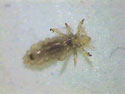 Head Lice Photos (photo) | Nebraska Extension in Lancaster County