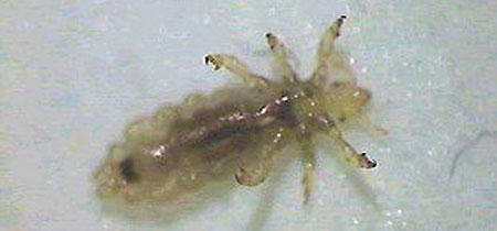 lice head hair infested moving lancaster cleaning faq should children unl pest edu answers questions rash friend
